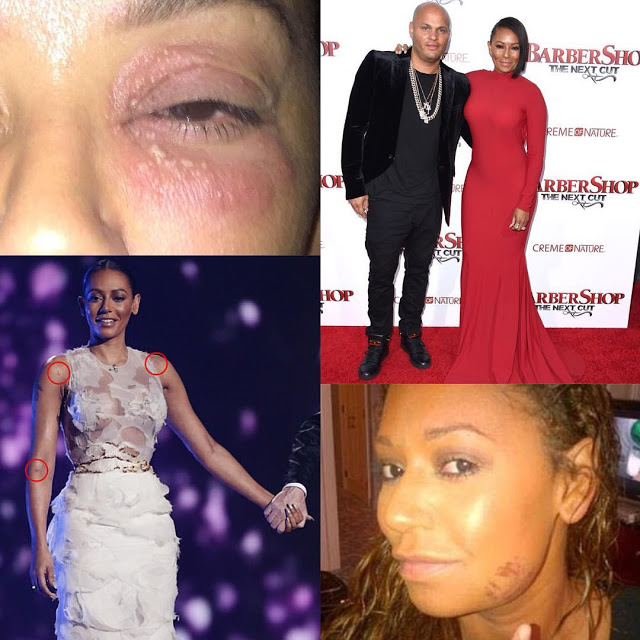 Mel B Went Further To Disclose That When S