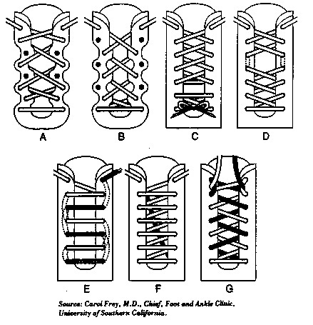 Roj - Fashion & Lifestyle: How To Thread Shoe / Boot Laces