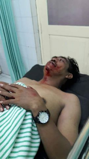 GURU NGAJI ANGGOTA FPI LUKA-LUKA SAAT DEMO AHOK DI PENJARINGAN GURU NGAJI ANGGOTA FPI LUKA-LUKA SAAT DEMO AHOK DI PENJARINGAN