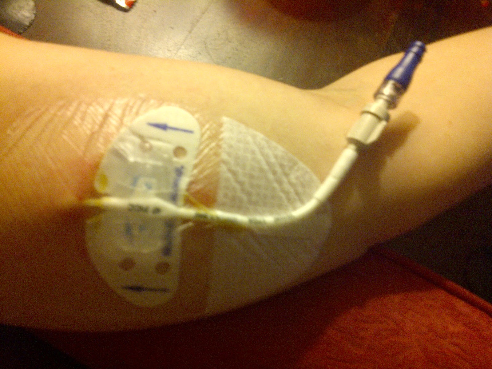 Me and my cancer journey PICC and mix