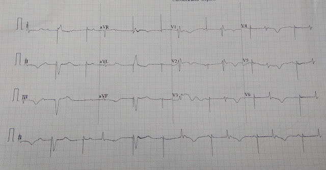 Cardiology window: Pacemaker failure to capture