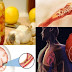 NO MORE: HEART ATTACK – STROKE – CLOGGED ARTERIES WITH THIS POWERFUL DRINK