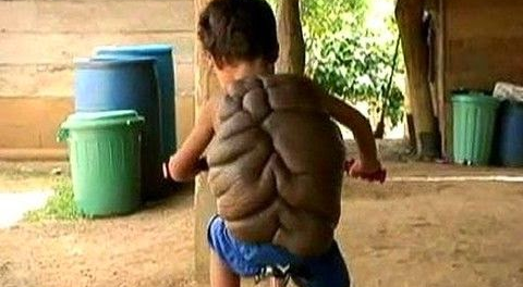 Το παιδί χελώνα The turtle child