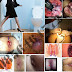 Salep Anti Bengkak Wasir Yg Berkhasiat thumbnail