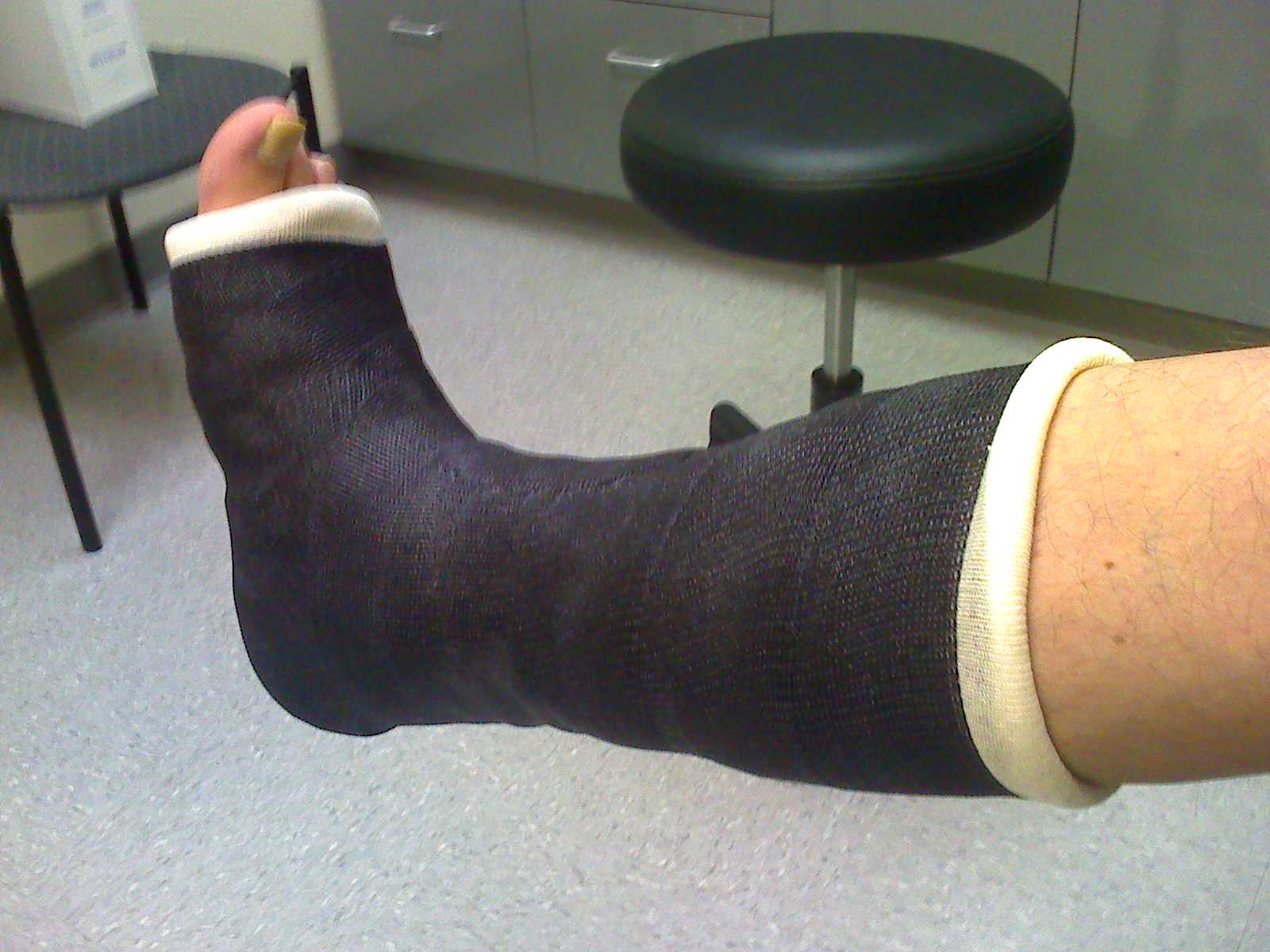 Surviving Oakridge: Broken Ankle