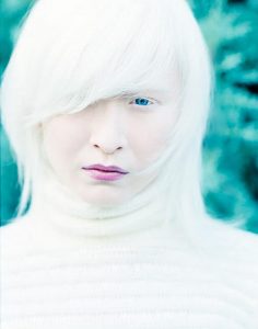 Sıradışı Ten Rengine Sahip 5 İnsan Connie Chiu,benzersiz ten renkleri,sıradışı ten renkleri,body color