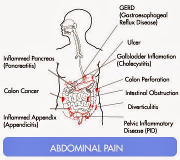 ICD 9 Code For Abdominal Pain