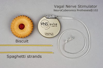 Epiphany: The Vagus Nerve and Autism