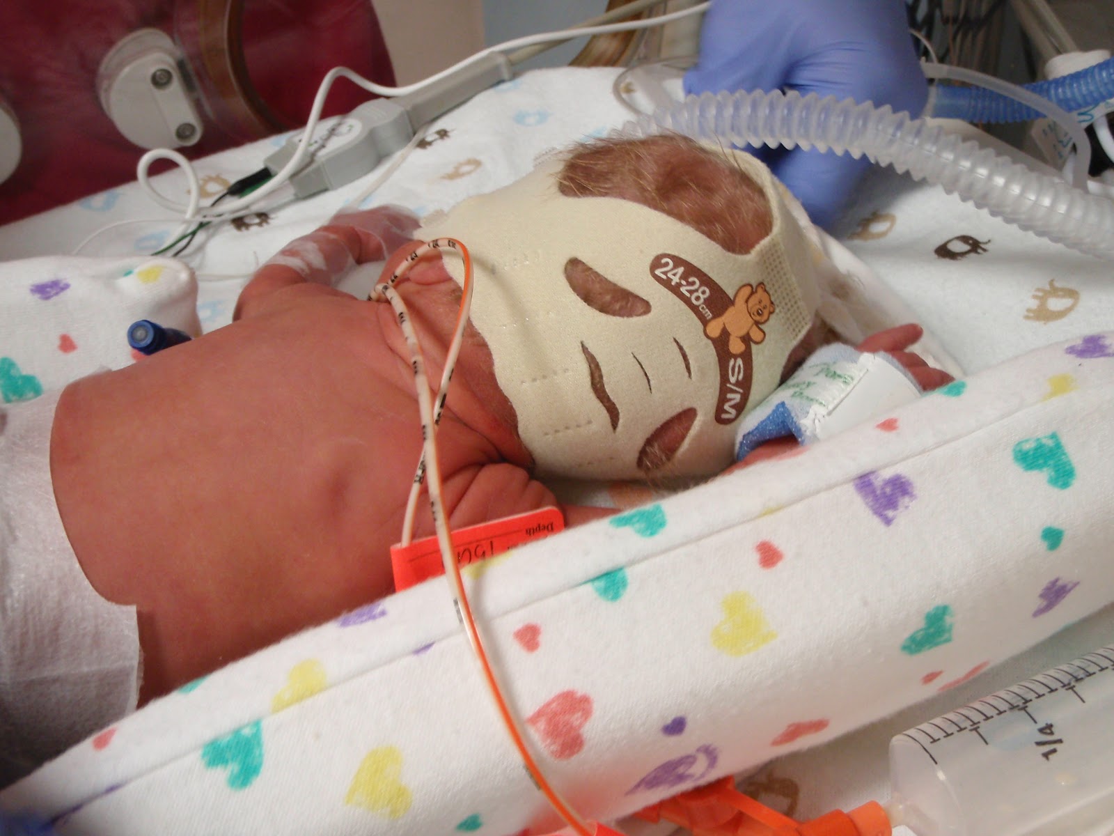 Connor Twins Oxygen for the babies