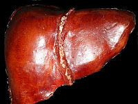 Liver In Body Diagram Liver In Body Diagram
