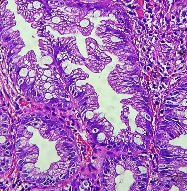 GASTROINTESTINAL AND LIVER HISTOLOGY PATHOLOGY ATLAS COLON Gastrointestinal and liver histology pathology atlas colon