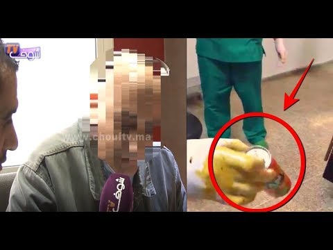 أول خروج إعلامي للطبيب اللي خَـــرج ''كانيط فانتا'' من مؤخرة شاب بالقنيطرة يكشف تفاصيل صادمة.. أول خروج إعلامي للطبيب اللي خَـــرج ''كانيط فانتا'' من مؤخرة شاب بالقنيطرة يكشف تفاصيل صادمة..