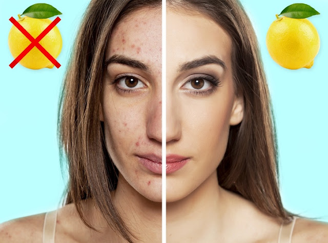 Manfaat Buah Lemon Untuk Kesehatan dan Kecantikan