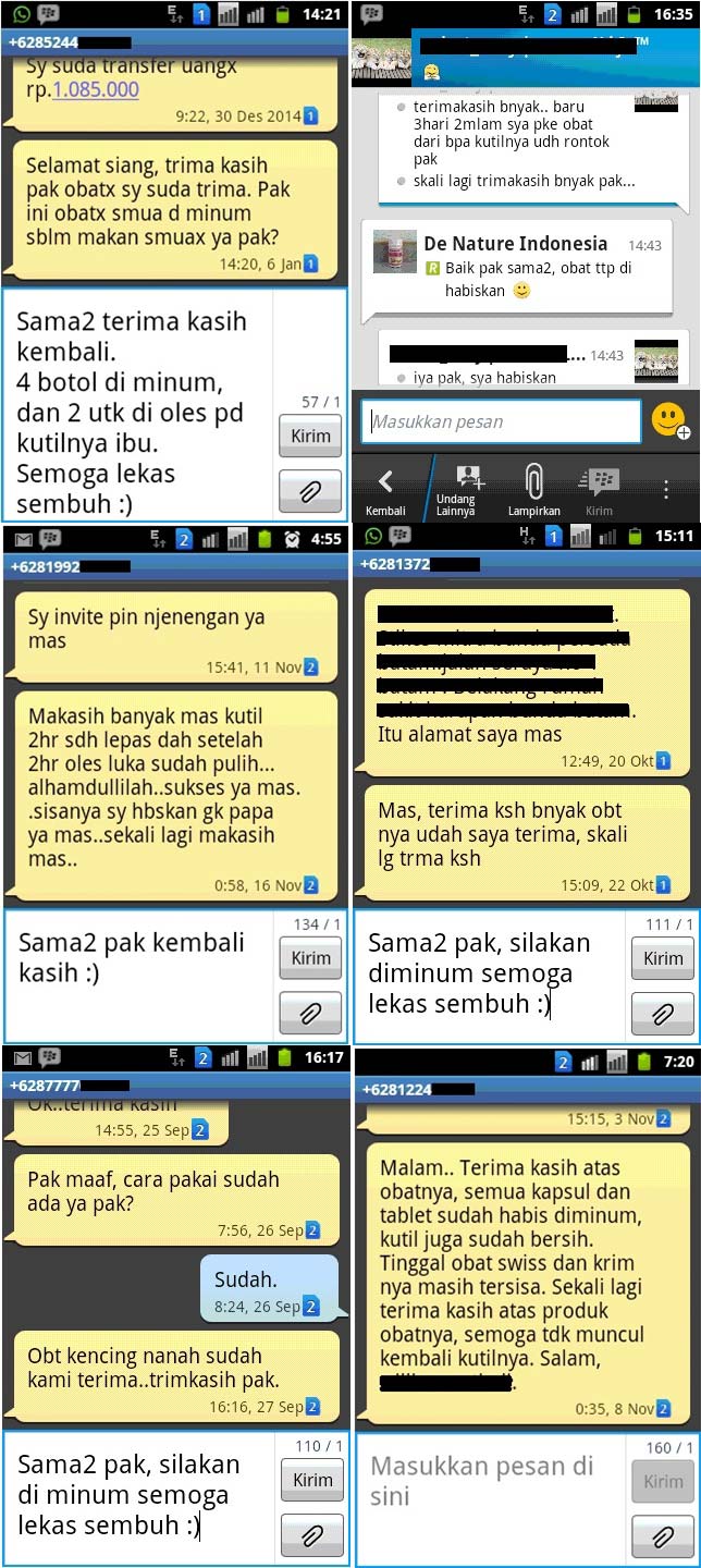 Testimoni obat kutil kelamin Testimoni obat kutil kelamin