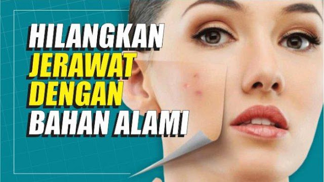 Cara Menghilangkan Jerawat dan Bekasnya dengan Bahan Alami