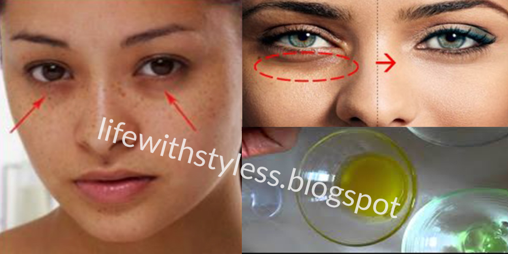 The Best Homemade Eye Brightening & Dark Circle Removing Serum Life