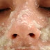 How To Quickly Wipe off The Dark Spots on Your Face