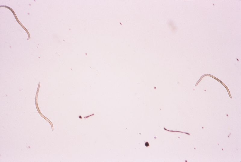 helminth infections onchocerciasis