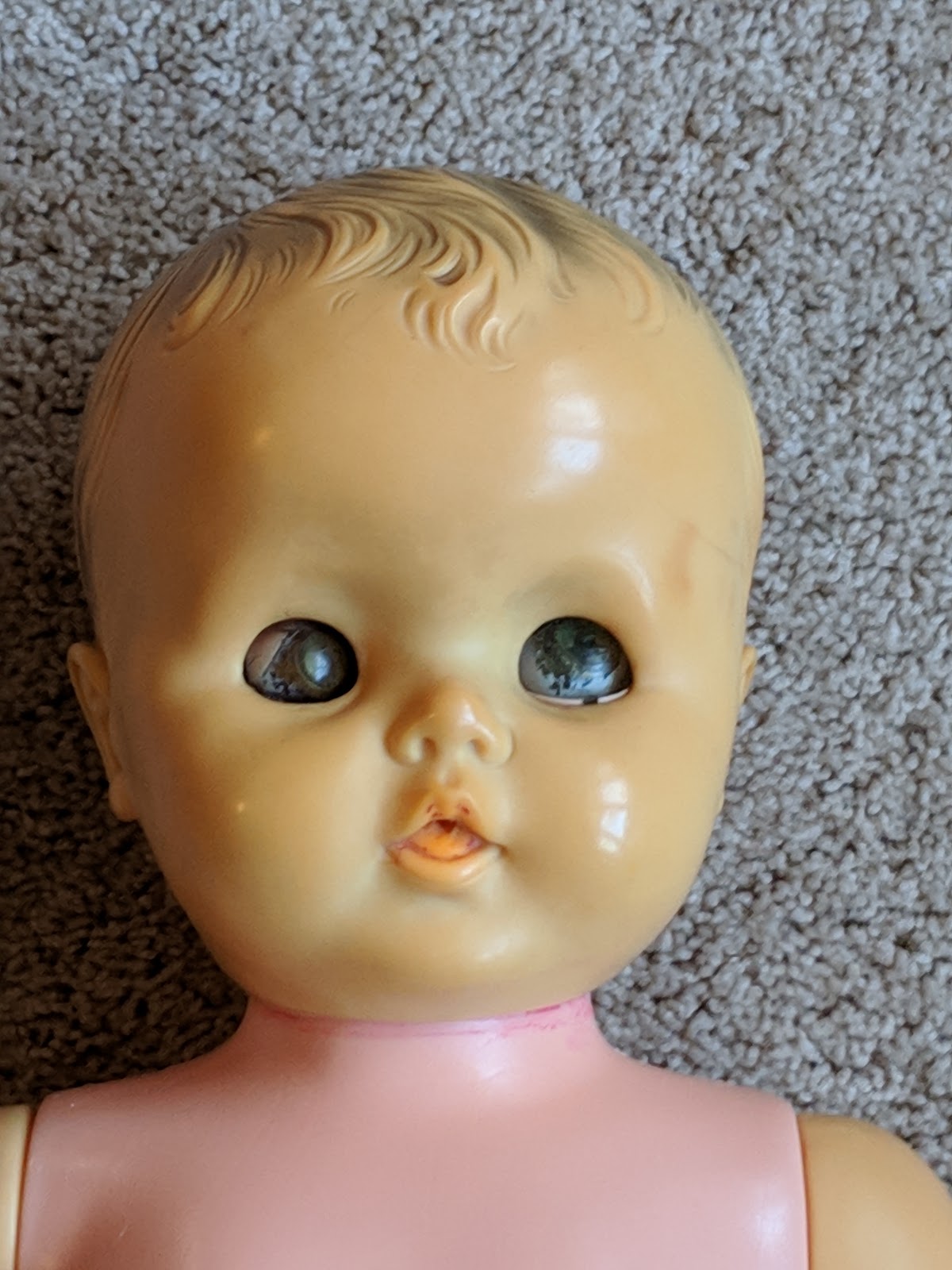 doll eye restoration