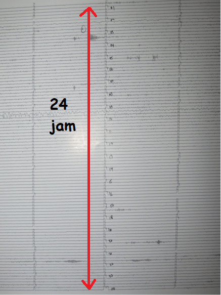 Earthquake Seismograph Analog as Earthquake Instrumentation