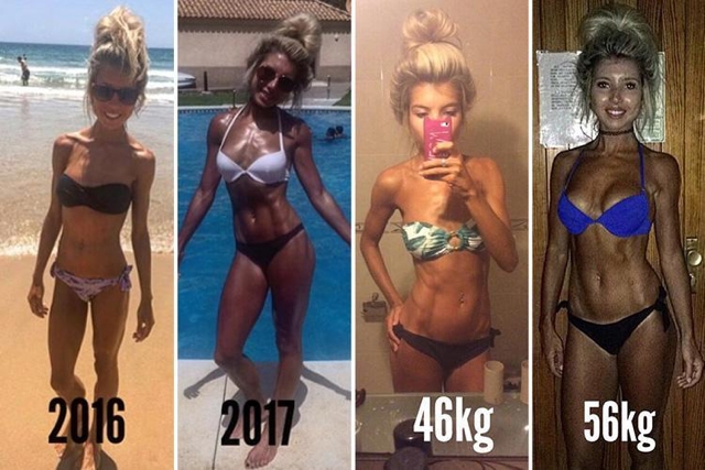 Gemelas consumieron cuatro mil calorías diarias para subir de peso Aoife у Ciara Tabb