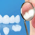 Bọc răng sứ hiệu quả với cầu răng và mão răng