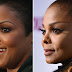 Plastic surgeon says Janet Jackson’s nose appears to be ‘collapsing’