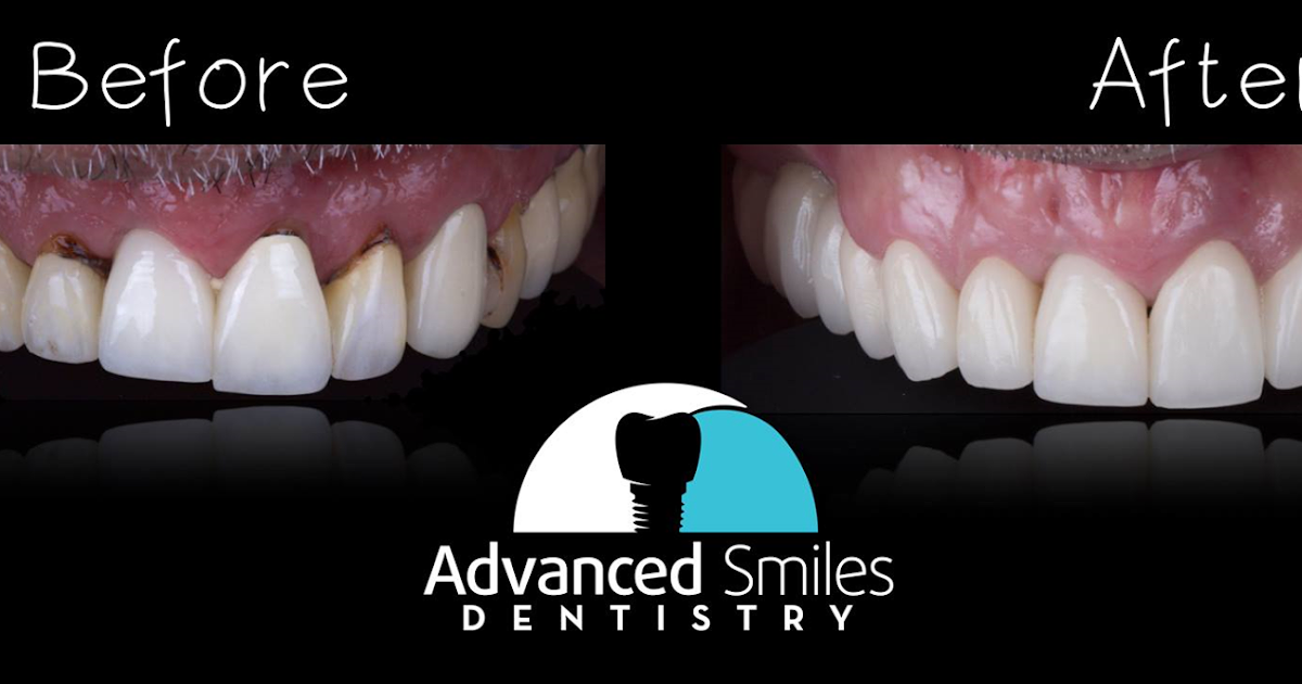 Dentist in Tijuana/Cosmetic Dentistry