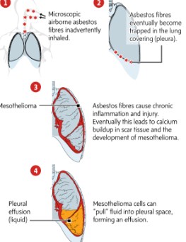 How Clever a Person Get Subjected toasbestos Amphibole Fiber? How Clever a Person Get Subjected toasbestos Amphibole Fiber?