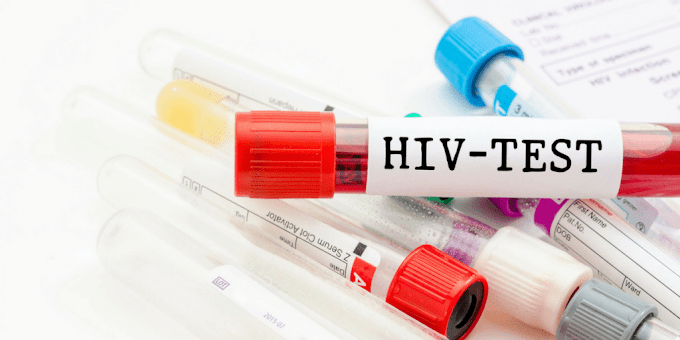 Ujian Saringan HIV