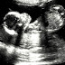 FECONDAZIONE ASSISTITA. SCOPERTA: con cellule staminali si è riusciti a produrre e far crescere un embrione...
