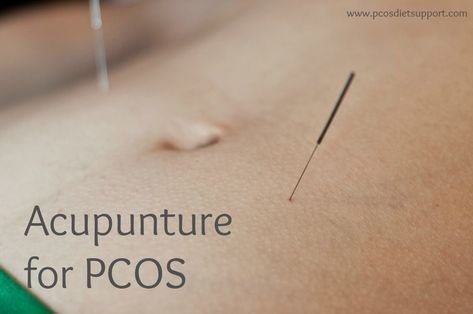 Akupunktur untuk promil PCOs Akupunktur untuk promil PCOs