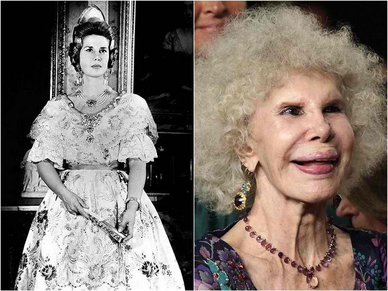 The Duchess Of Alba Plastic Surgery