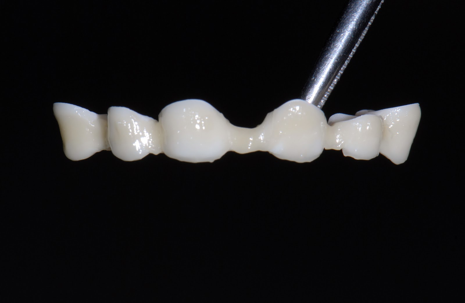 Dental Aesthetics: Prótesis Dental