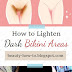 How to Lighten Dark Bikini and Thigh Areas