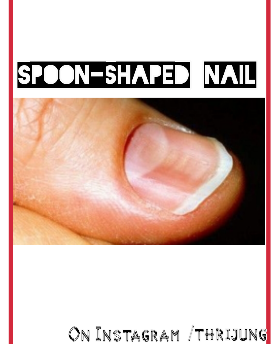 Five tips that nail say about your healthSee how(2019) Thrijung