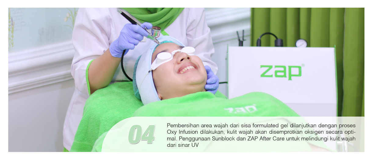 [Review] ZAP Photo Facial Acne My First Time Doing Acne Treatment at ZAP