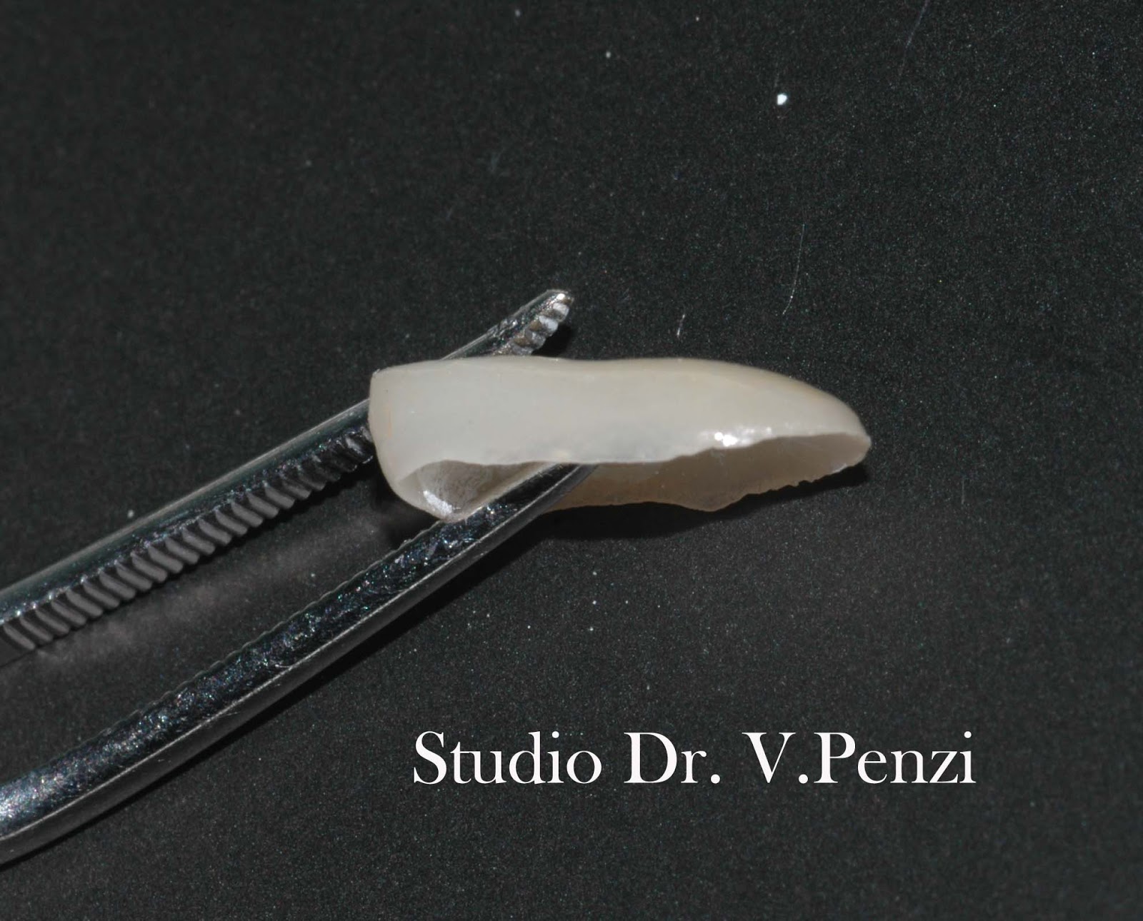 AZDENT Scatola Per Il Trattamento Dei Denti Con Patch Per La Pretrattamento Della Impiallacciatura Dentale Scatola Per La Conservazione Della Protesi - Foto 11