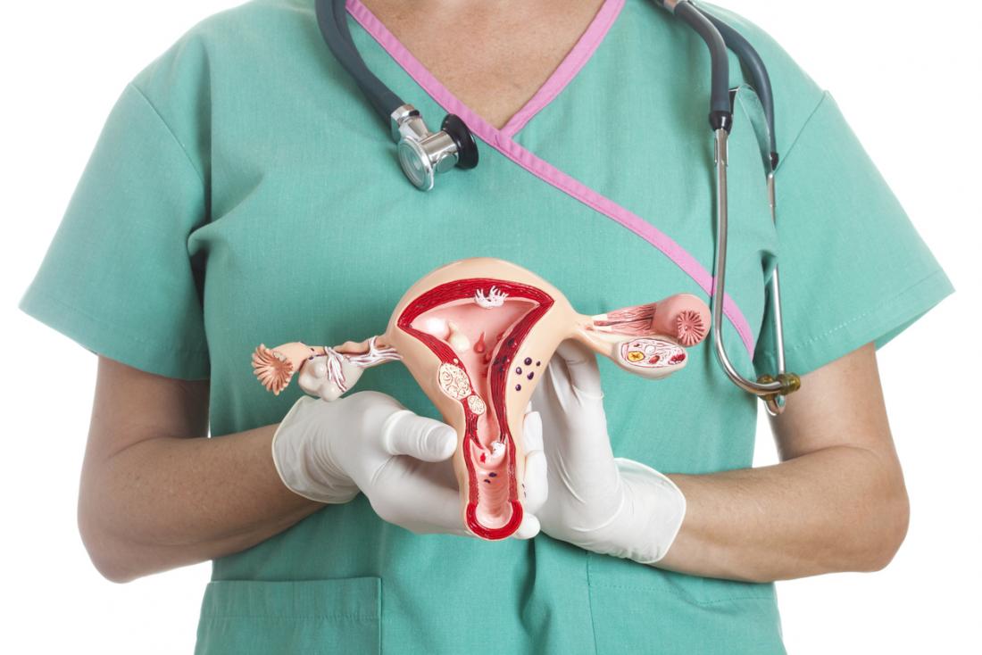 Enlarged uterus Causes, symptoms, and treatment Medical Nepal