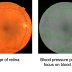 Assessing Cardiovascular Risk Factors with Computer Vision