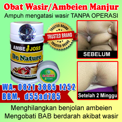 Cara Mengobati Ambeien Wasir Dengan Cepat Tanpa Operasi