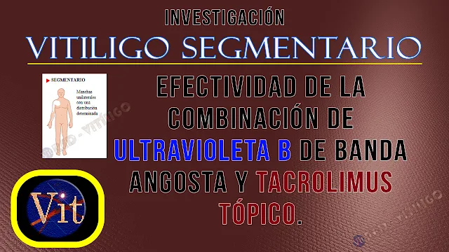 Vitiligo Segmentario│Tratamiento efectivo con Ultravioleta B de Banda Angosta y Tacrolimus Tópico