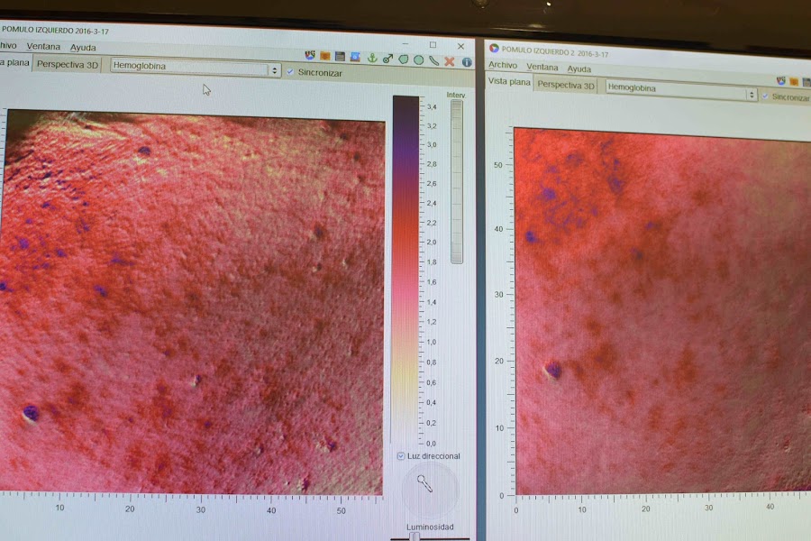 "Skin Genomic Center Barcelona"