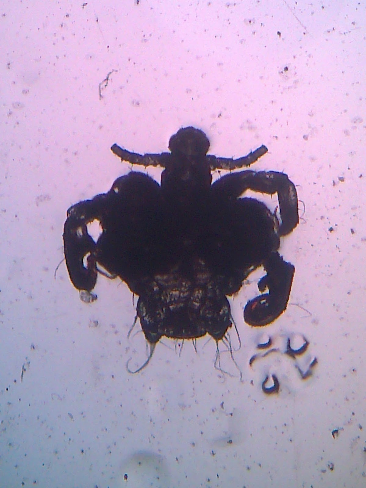 Parasitología Tecnologia Medica UST La Serena 2012 Phthirus pubis
