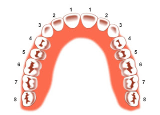 niềng răng phải nhổ 4 cái răng cùng lúc?