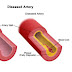 DO YOU SUFFER FROM POOR CIRCULATION? HERE IT IS HOW TO SOLVE THE PROBLEM IN ONLY 30 MINUTES!