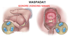 Foto Jual Obat Untuk Penis Keluar Nanah Di Apotik Umum