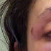 Marido é preso por agredir mulher que bebia com amigos em bar