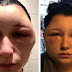 Woman’s head doubles in size after allergic reaction to hair dye