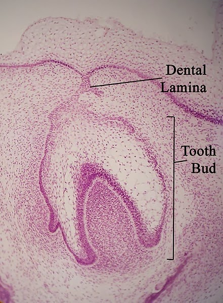 dental lamina and dental bud